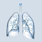 Lung Cancer